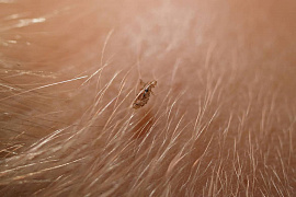 Ловить вшей - фото №1