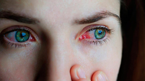 Что значит Нездоровые глаза во сне