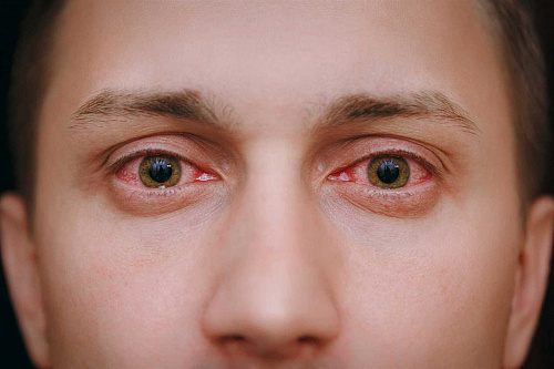 Что значит Исчезновение глаз во сне
