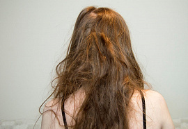 Колтун (болезнь волос) - фото №7